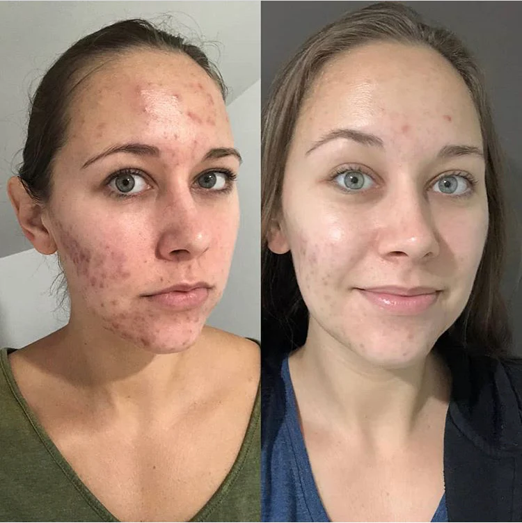 Bd - Luminosity Face Serum - Image 3