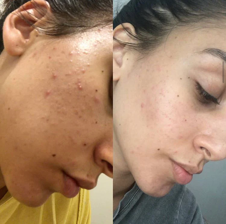 Bd - Luminosity Face Serum - Image 5