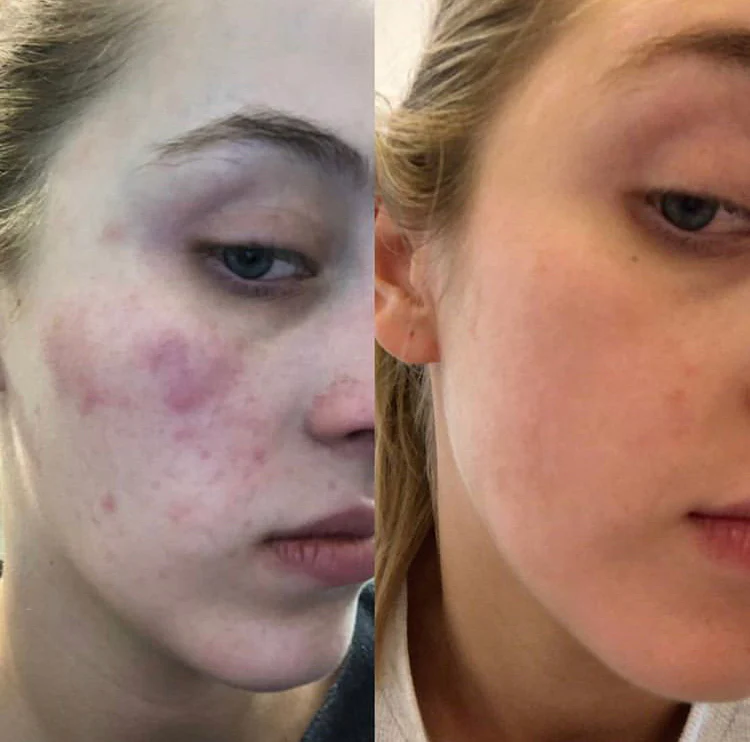 Bf - Restore Face & Body Serum - Image 3