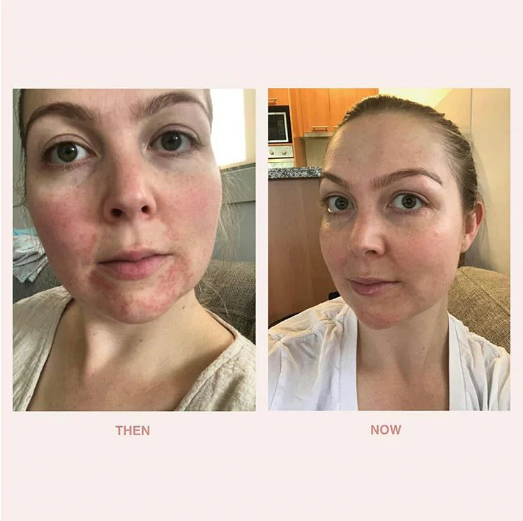 Bf - Restore Face & Body Serum - Image 6