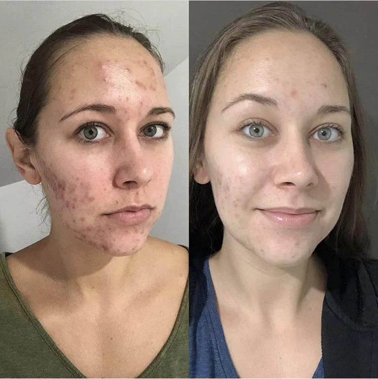 Save My Skin Bundle - Full Pack - Image 6