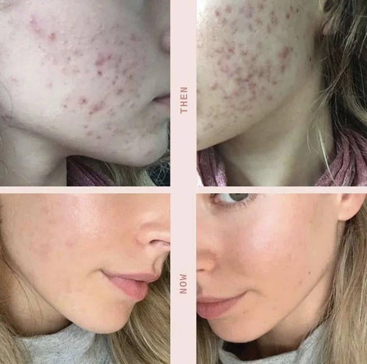 Save My Skin Bundle - Full Pack - Image 7