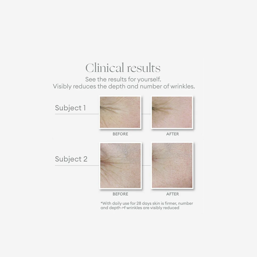 Phytofuse Renew Resveratrol Oogcrème - Image 5